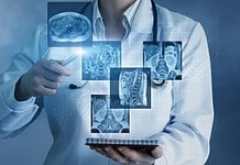 Poca claridad sobre efectos en la salud del internet 5G